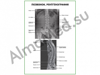 Позвонок. Рентгенография плакат ламинированный А1/А2 (ламинированный	A2)