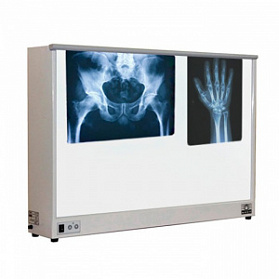 НС2-02-"ПОНИ" Негатоскоп двухкадровый, экран 430х700 мм