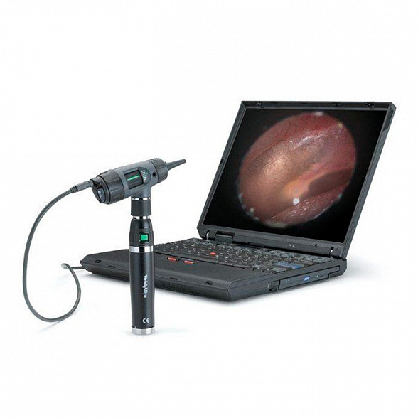 Отоскоп MacroView со встроенным диагностическим фонариком, номер по каталогу 23820