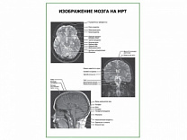 Изображение мозга на МРТ плакат глянцевый А1/А2 (глянцевый A1)