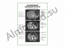 Сканирование брюшной полости плакат ламинированный А1/А2 (ламинированный	A2)