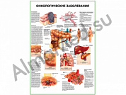 Онкологические заболевания плакат глянцевый/ламинированный А1/А2 (глянцевый	A2)