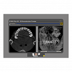 Fona XPan 3D - рентгенографическая цифровая система панорамной съемки