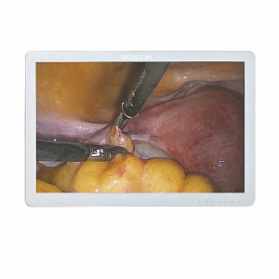 Монитор для эндоскопа 24 дюйма Huger