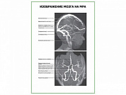 Изображение мозга на МРА плакат глянцевый А1/А2 (глянцевый A1)