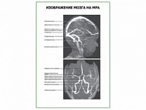 Изображение мозга на МРА плакат глянцевый А1/А2 (глянцевый A1)