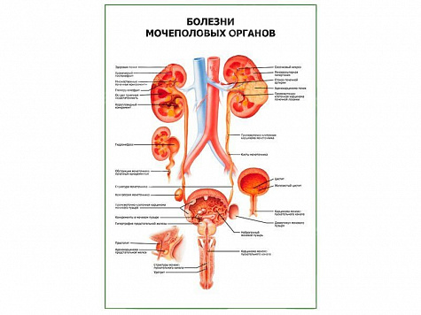 Болезни мочеполовых органов плакат глянцевый А1/А2 (глянцевый A2)