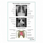 Рентгенография и аускультация сердца плакат глянцевый  А1+/А2+ (глянцевый холст от 200 г/кв.м, размер A1+)