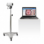 Видеокольпоскопы С3A/С6A, Edan