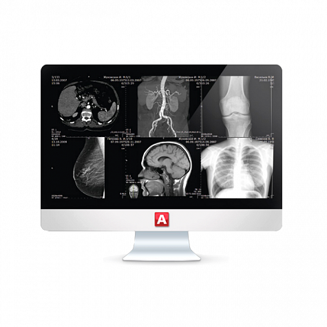Информационная система АПК АрхиМед PACS/RIS