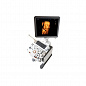 УЗИ аппарат SonoAce R7 Samsung Medison
