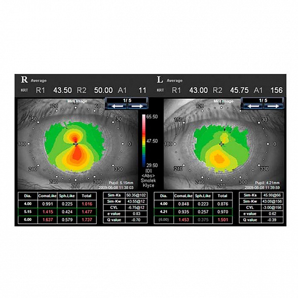 Анализатор волнового фронта KR-1W, Topcon
