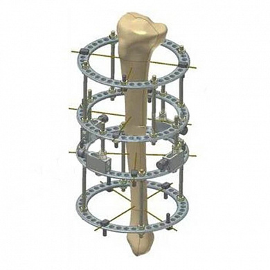 Комплект деталей аппарата Илизарова для взрослых