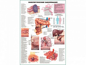 Онкологические заболевания плакат глянцевый А1/А2 (глянцевый A2)