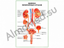 Болезни мочеполовых органов плакат глянцевый/ламинированный А1/А2 (глянцевый A2)