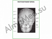 Рентгенография черепа плакат глянцевый/ламинированный А1/А2 (глянцевый	A2)