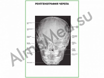 Рентгенография черепа плакат глянцевый/ламинированный А1/А2 (глянцевый	A2)