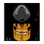 RAYSCAN Symphony Alpha SC - ортопантомограф с цефалостатом, 26х24 см