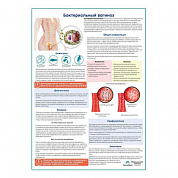 Бактериальный вагиноз медицинский плакат А1+/A2+ (матовый холст от 200 г/кв.м, размер A1+)