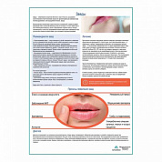 Заеды медицинский плакат А1+/A2+ (глянцевая фотобумага от 200 г/кв.м, размер A2+)