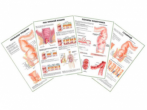 Комплект плакатов для кабинета проктолога глянцевый А1/А2 (глянцевый A2)