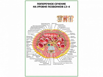 Поперечное сечение на уровне L 3-4 плакат глянцевый  А1/А2 (глянцевый A2)