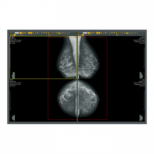 Аппаратно-программный комплекс «ДИАРМ-МТ-Плюс»
