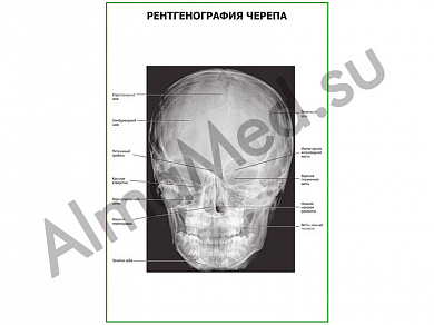 Рентгенография черепа плакат ламинированный А1/А2 (ламинированный	A2)