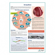 Энтеробиоз (острицы) медицинский плакат А1+/A2+ (матовый холст от 200 г/кв.м, размер A1+)