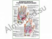 Строение запястья, ладонный разрез плакат глянцевый/ламинированный А1/А2 (глянцевый	A2)