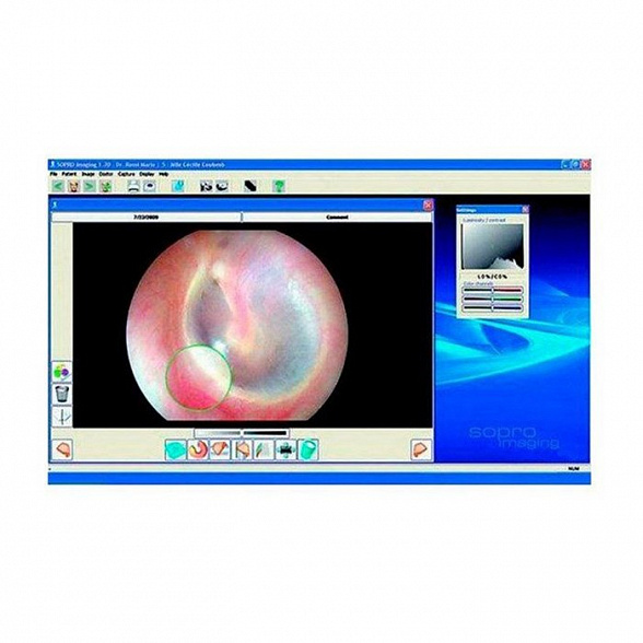 Эндовидеокамера SOPRO 181 UBICAM PLUS PAL: Видеокамера Ubicam + одна лицензия программы SOPRO IMAGING Medical + объектив