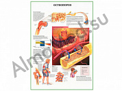Остеопороз плакат глянцевый/ламинированный А1/А2 (глянцевый A2)