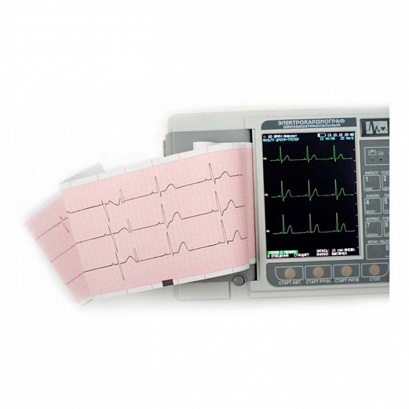 Электрокардиограф ЭК12Т-01-"Р-Д" 12 канальный, портативный, с экраном 141 мм НПП Монитор