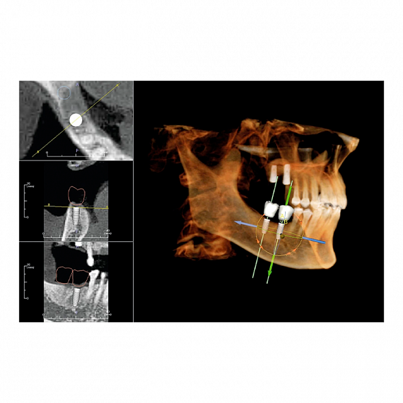 Instrumentarium OP 3D Vision V8 - панорамный томограф