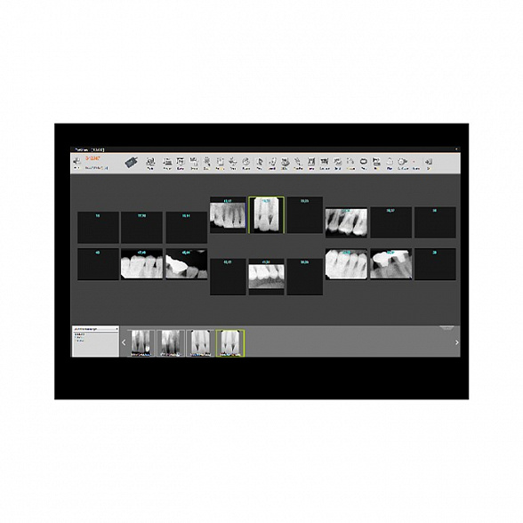 Genoray X-RAY SENSOR E9525 - радиовизиографическая система