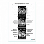 Сканирование брюшной полости плакат глянцевый  А1+/А2+ (глянцевая фотобумага от 200 г/кв.м, размер A1+)