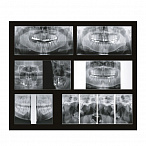 Papaya 3D Plus 16x8 - компьютерный томограф с цефалостатом