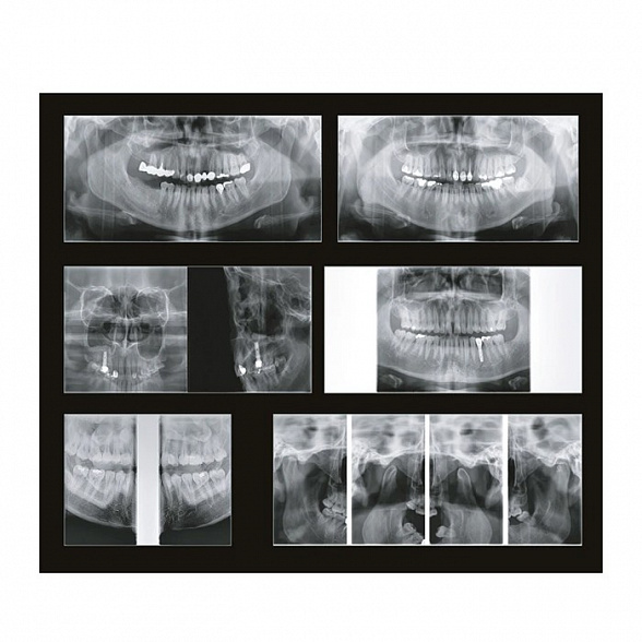Papaya 3D Plus 16x8 - компьютерный томограф с цефалостатом