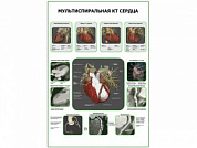 Мультиспиральная КТ Сердца плакат глянцевый  А1/А2 (глянцевый A2)