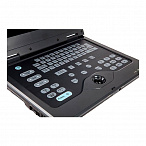 Портативный УЗИ сканер AcuVista RS880c