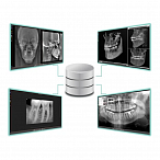FONA Stellaris - система компьютерной стоматологической радиографии