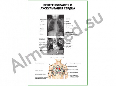 Рентгенография и аускультация сердца плакат ламинированный А1/А2 (ламинированный	A2)