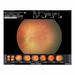 Педиатрическая ретинальная камера RetCam 3