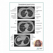 Сканирование грудной клетки плакат глянцевый  А1+/А2+ (глянцевая фотобумага от 200 г/кв.м, размер A2+)