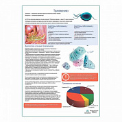 Трихомониаз медицинский плакат А1+/A2+ (глянцевый холст от 200 г/кв.м, размер A1+)