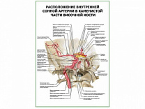 Расположение внутренней сонной артерии в каменистой части височной кости плакат глянцевый А1/А2 (глянцевый A1)