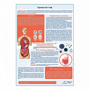 Брюшной тиф медицинский плакат А1+/A2+ (глянцевая фотобумага от 200 г/кв.м, размер A2+)