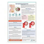Бактериальный вагиноз медицинский плакат А1+/A2+ (глянцевый холст от 200 г/кв.м, размер A1+)