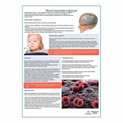 Менингококковая инфекция медицинский плакат А1+/A2+ (глянцевая фотобумага от 200 г/кв.м, размер A2+)