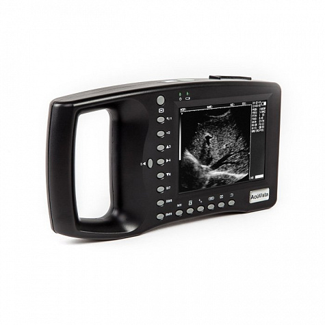 Портативный УЗИ сканер AcuVista RS880b